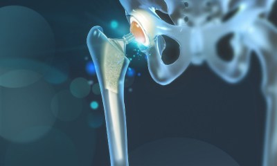 Bioceramics